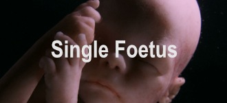 Single Foetus